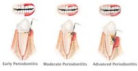 Gc dental world logo