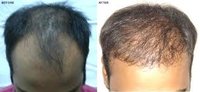 hair Transplant Clinic logo
