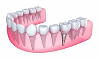 Dr. Gowd’s Dental Hospitals logo