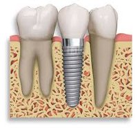 Dr. Gowd’s Dental Hospitals logo